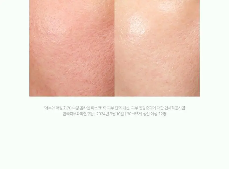 [탄력케어] 아누아 콜라겐 마스크 1매 3종(어성초/복숭아/라이스) 상세페이지 13